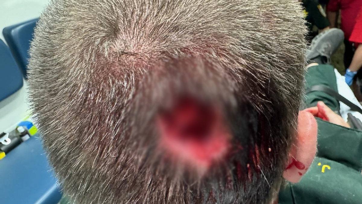 Florida man bit chunk out of deputy’s head at music festival: sheriff’s office